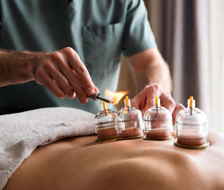 newcupping-